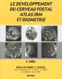 Le Développement Du Cerveau Foetal, Atlas Irm Et Biometrie - Preview