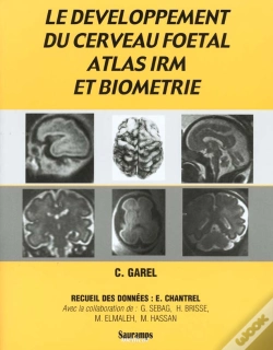 Capa do artigo Le Développement Du Cerveau Foetal, Atlas Irm Et Biometrie
