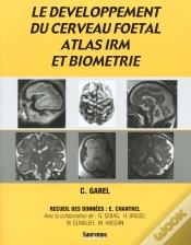 Capa do artigo Le Développement Du Cerveau Foetal, Atlas Irm Et Biometrie