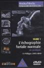 L'Echographie Foetale Normale Vol 1 - Preview