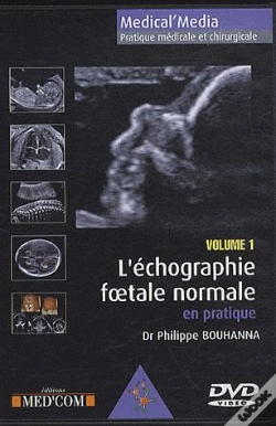 Capa do artigo L'Echographie Foetale Normale Vol 1