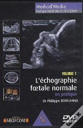 L'Echographie Foetale Normale Vol 1
