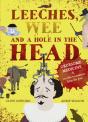 Leeches, Wee And A Hole In The Head - Preview