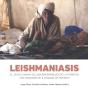 Leishmaniasis - Preview