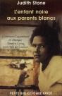 L'Enfant Noire Aux Parents Blancs ; Comment L'Apartheid Fit Changer Sandra Laing Trois Fois De Couleur - Preview