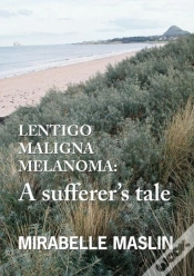 Capa do artigo Lentigo Maligna Melanoma