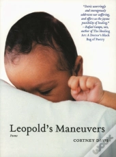 Leopold'S Maneuvers