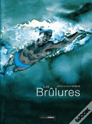 Les Brûlures