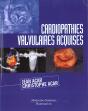 Les Cardiopathies Valvulaires Acquises - Preview