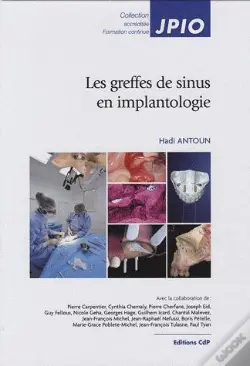 Les Comblements Sinusiens En Implantologie