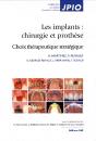 Les Implants : Chirurgie Et Prothèse - Preview
