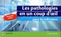 Les Pathologies En Un Coup D'Oeil Pour Les Infirmiers - Preview
