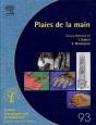 Les Plaies De La Main - Preview