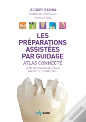 Les Préparations Assistées Par Guidage ; Atlas Connecté