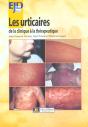 Les Urticaires ; De La Clinique A La Therapeutique - Preview
