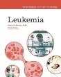 Leukemia - Preview