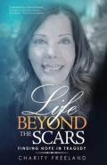 Life Beyond The Scars