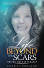Life Beyond The Scars - Preview
