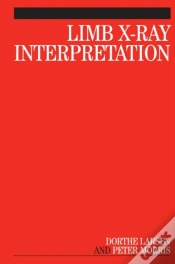 Capa do artigo Limb X-Ray Interpretation