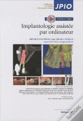 L'Implantologie Assistee Par Ordinateur