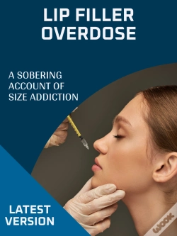 Capa do artigo Lip Filler Overdose