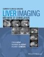 Liver Imaging - Preview