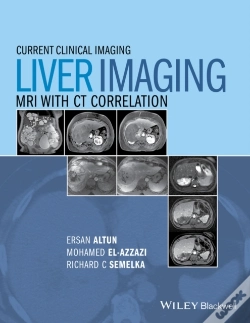 Capa do artigo Liver Imaging