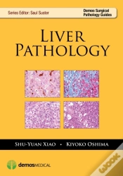 Capa do artigo Liver Pathology