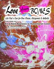 Loves Them Bones  Lets Find A Cure For Bone Disease, Osteoporosis & Arthritis   Challenge 2017