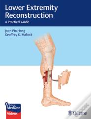 Lower Extremity Reconstruction
