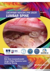 Capa do artigo Lumbar Spine
