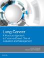 Lung Cancer: A Practical Approach To Evidence-Based Clinical Evaluation And Management - Preview
