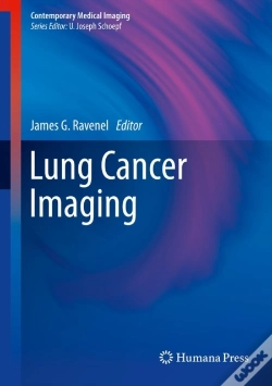 Capa do artigo Lung Cancer Imaging