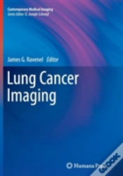 Capa do artigo Lung Cancer Imaging