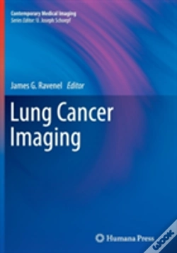 Capa do artigo Lung Cancer Imaging
