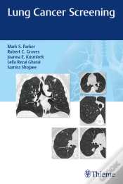 Capa do artigo Lung Cancer Screening