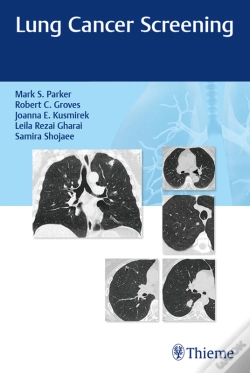 Capa do artigo Lung Cancer Screening