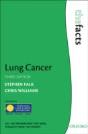 Lung Cancer - Preview