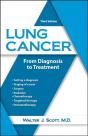 Lung Cancer - Preview