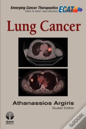 Capa do artigo Lung Cancer