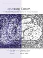 Lung Cancer - Preview
