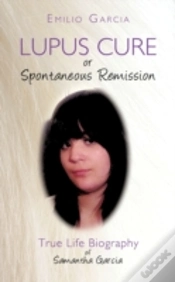 Capa do artigo Lupus Cure Or Spontaneous Remission: Tru