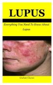 Lupus