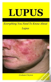 Capa do artigo Lupus