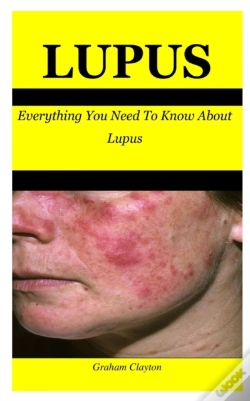 Capa do artigo Lupus