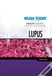 Lupus