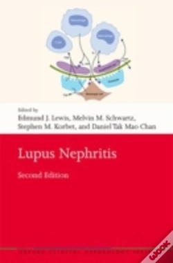 Capa do artigo Lupus Nephritis