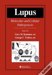 Capa do artigo Lupus