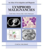 Lymphoid Malignancies - Preview