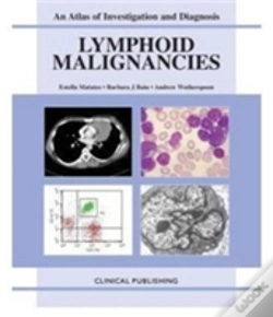 Capa do artigo Lymphoid Malignancies